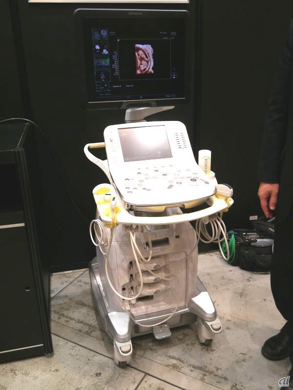 医療分野における超音波診断装置を活用した先端医療の提案。