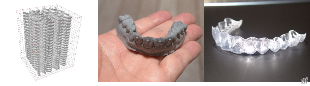 3Dプリンターを活用した歯科矯正用マウスピース（出典：ヤマト運輸）