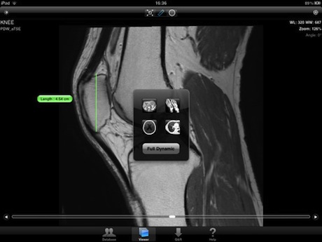 iPadネイティブ対応版「Osirix HD」のスクリーンショット
