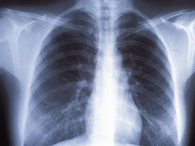 病院の画像装置、8割がサポート切れのOS使用--米調査