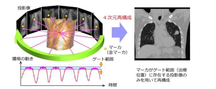 4次元CBCTの概要（出典：北海道大学、日本医療研究開発機構、日立）